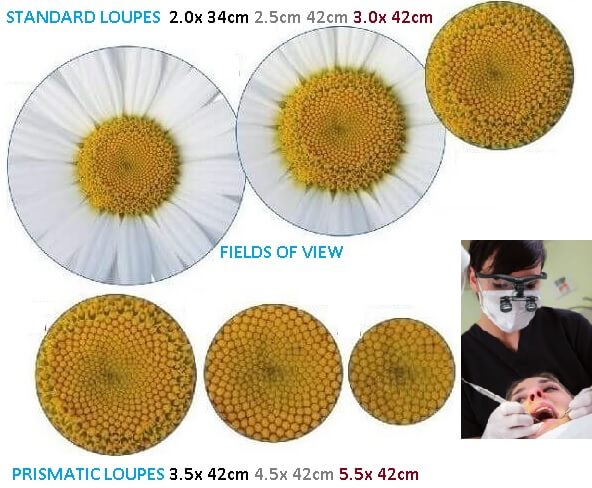 Keeler loupe field of view