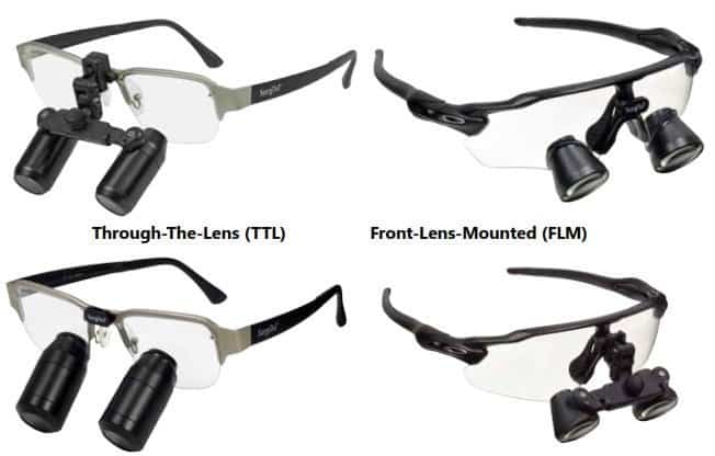 loupe types