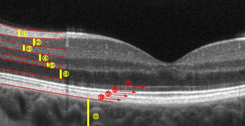 retinal layers