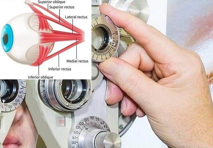 eye-muscle balance